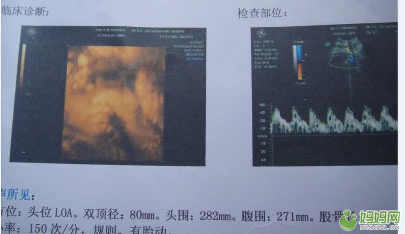 揭秘胎儿性别揭晓时间，B超几个月可以看男女？