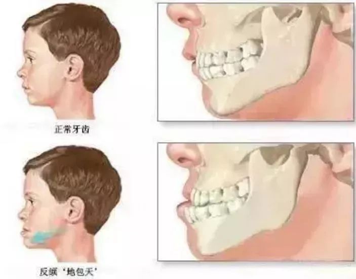 宝宝十四个月，牙齿生长的关键里程碑