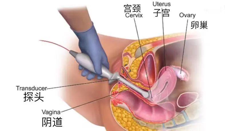 窦卵泡的每月变化，探索其规律与差异